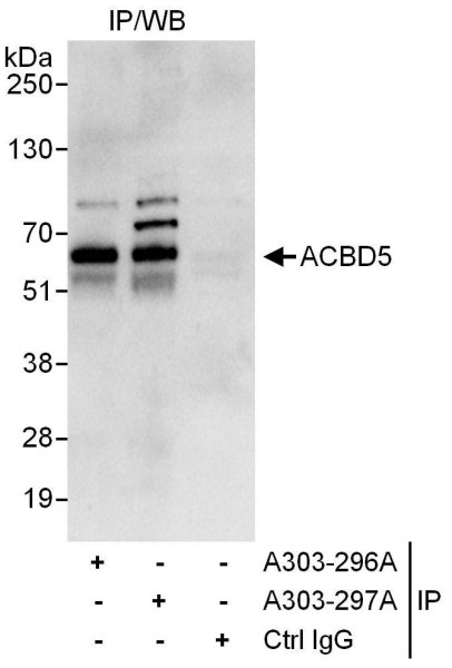 Anti-ACBD5