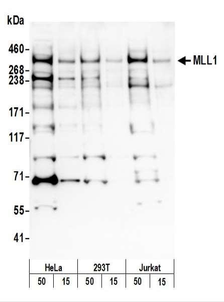 Anti-MLL1