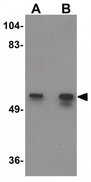 Anti-KPNA2 / IPOA1