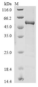 AP-2 complex subunit mu (AP2M1), human, recombinant