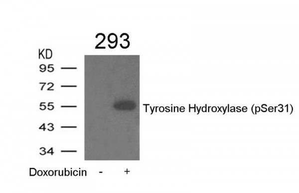 Anti-phospho-Tyrosine Hydroxylase (Ser31)