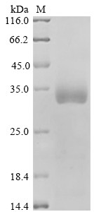 Dual specificity mitogen-activated protein kinase kinase 4 (MAP2K4), human, recombinant