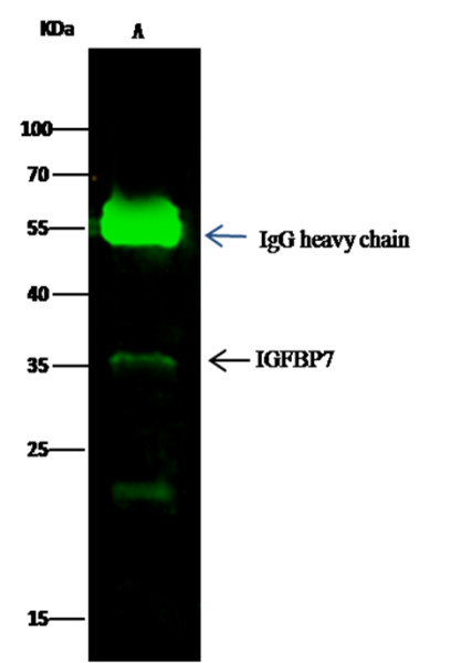 Anti-IGFBP7 Monoclonal Recombinant Antibody