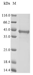 BCL2/adenovirus E1B 19 kDa protein-interacting protein 3-like (BNIP3L), partial, human, recombinant