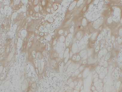 Anti-Collagen II