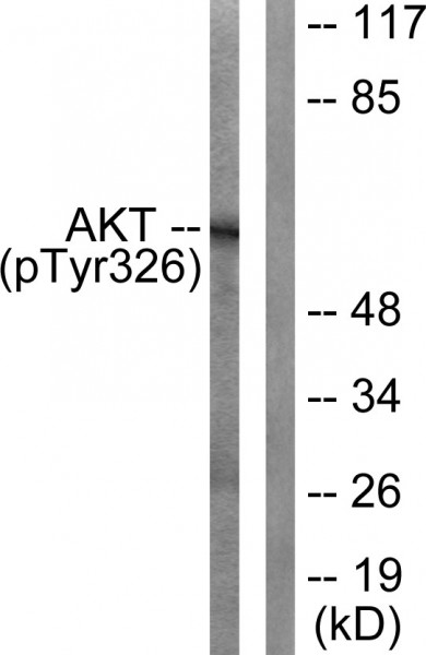 Anti-phospho-Akt (Tyr326)