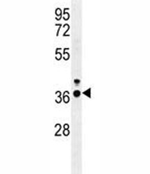 Anti-IRF-1