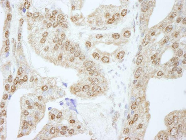 Anti-Cyclin E1 (IHC)