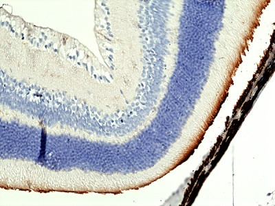 Anti-MerTK (mouse), Rabbit Monoclonal (RM469)