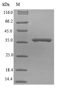 Matrix protein (M), Rabies virus, recombinant