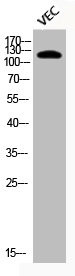 Anti-Phospho-HDAC5 (S498)