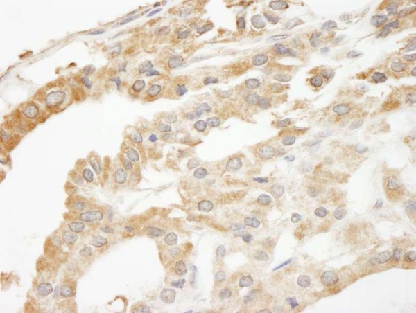 Anti-ABCF2 (IHC)