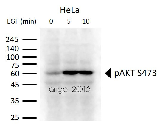 Anti-phospho-Akt (Ser473)