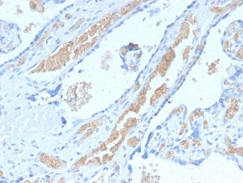 Anti-SPTA1 / Spectrin alpha 1, clone SPTA1/2939R