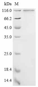 Serum albumin (Alb), Biotinylated, rat, recombinant