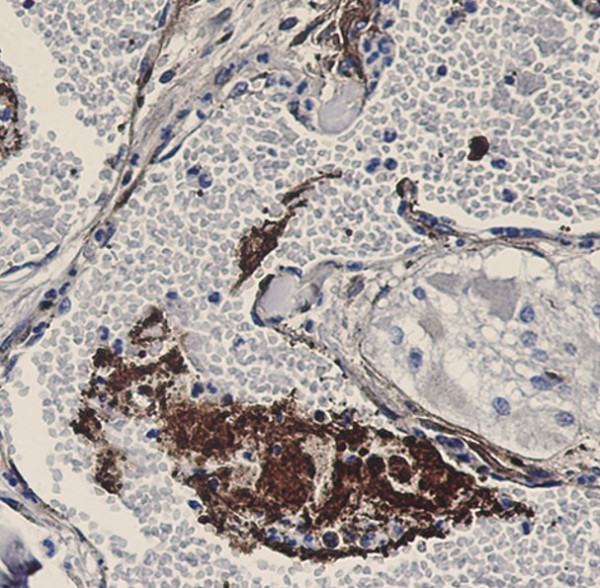 Anti-TSP1 / Thrombospondin 1