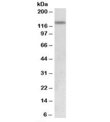 Anti-KDM2A