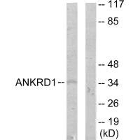Anti-ANKRD1