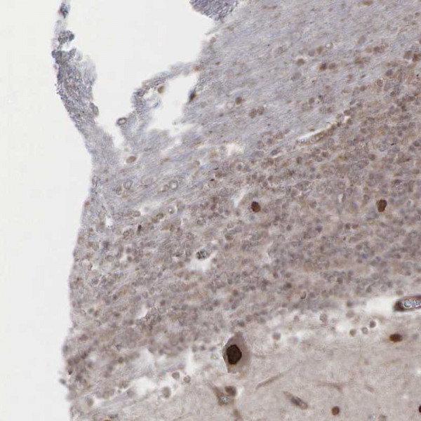 Anti-GPRASP1