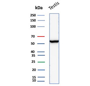 Anti-ESR2 / Estrogen Receptor beta, clone ESR2/6661