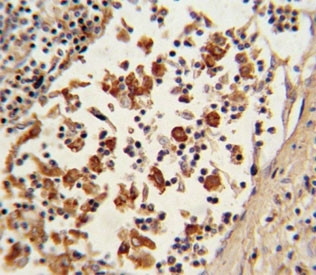Anti-BCL6