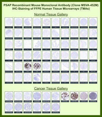 Anti-ACP3 / Prostatic acid phosphatase, clone MSVA-452M