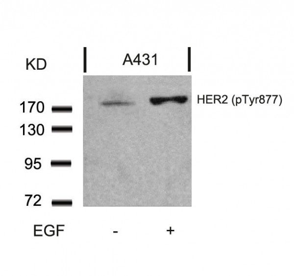 Anti-phospho-HER2 / ErbB2 (Tyr877)