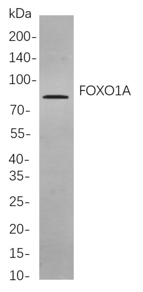 Anti-Recombinant FOXO1A, clone 8D2