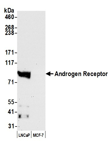 Anti-Androgen Receptor