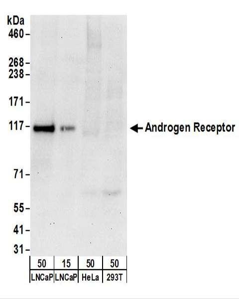 Anti-Androgen Receptor