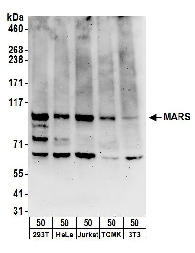 Anti-MARS