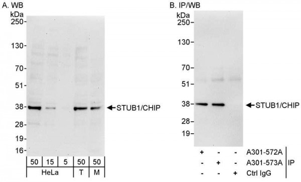 Anti-STUB1/CHIP