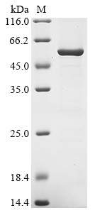Trimethylamine-N-oxide reductase 1 (torA), partial, Escherichia coli, recombinant