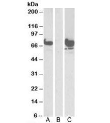 Anti-EPM2AIP1