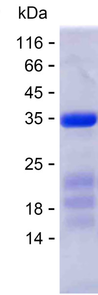 HDAC4 (human), recombinant protein