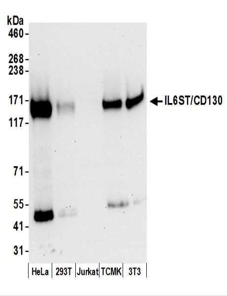Anti-IL6ST/CD130