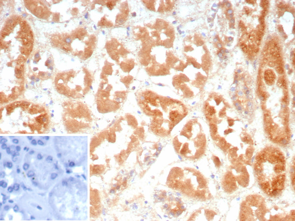 Anti-Cadherin-6 (CDH6) / K-Cadherin, recombinant antibody, clone CDH6/9300R