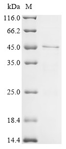 RAD51-associated protein 1 (RAD51AP1), human, recombinant