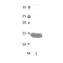 DFNB31_2 PDZ Domain
