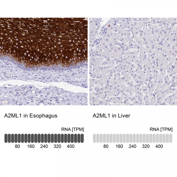 Anti-A2ML1
