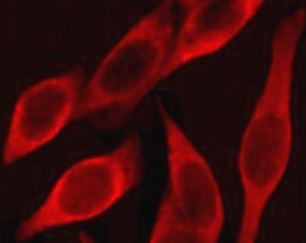 Anti-CD54 / ICAM1, clone 4F5-F9-F12