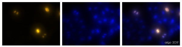 Anti-phospho-Histone H3.1S10ph (Ser10)