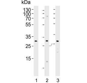 Anti-FOLR2 / Folate Receptor beta