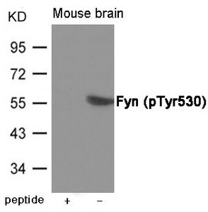 Anti-Phospho-FYN (Tyr530)