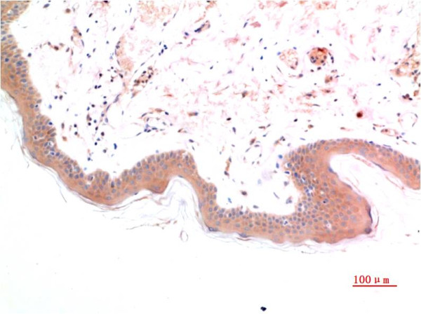 Anti-SMAD3 (phospho S425)