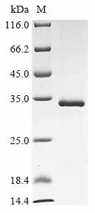 Envelope glycoprotein (env), partial, Bovine leukemia virus, recombinant