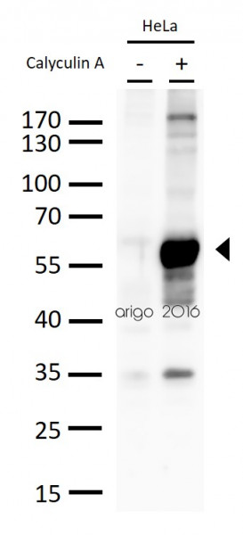 Anti-phospho-c-Myc (Ser62)