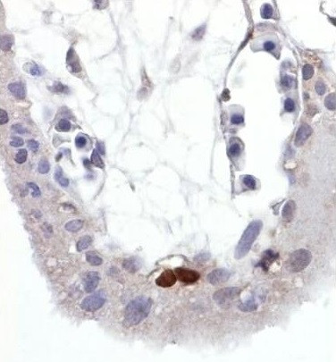 Anti-phospho-p53 (Ser392), clone FP3-2