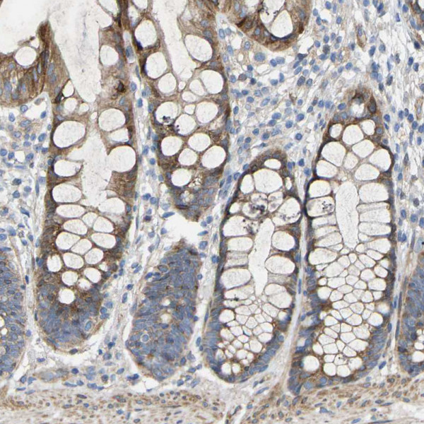 Anti-TOR1B