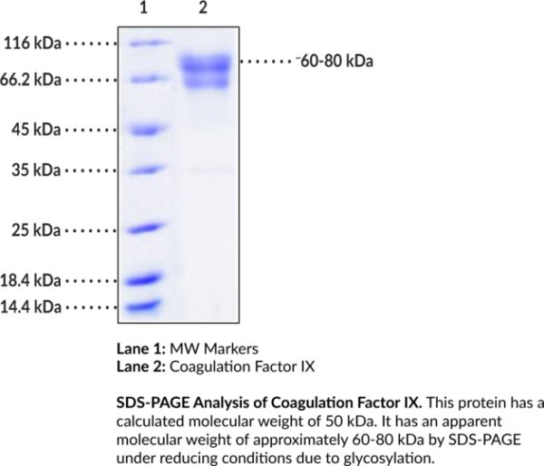 Coagulation Factor IX (human, recombinant)
